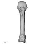 metacarpal fourth right
