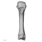 metacarpal third right