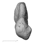 pisiform right