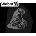 NH MER33 461 Gorilla gorilla gorilla triquetrum right ct stack movie