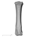 metacarpal third right