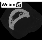 NH MER33 755 Gorilla gorilla gorilla hand phalanx fourth proximal right ct stack movie