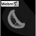 NH MER33 755 Gorilla gorilla gorilla hand phalanx second proximal right ct stack movie
