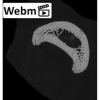 NH MER33 755 Gorilla gorilla gorilla hand phalanx third proximal right ct stack movie
