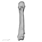 metacarpal fifth right