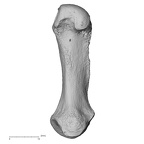 metacarpal first right