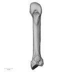 metacarpal second right