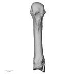 metacarpal third right