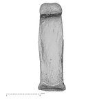 hand phalanx third proximal right