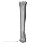 metacarpal fourth right