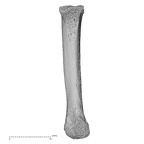 metacarpal second right