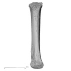 metacarpal third right