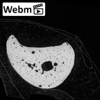 NH MER34 856 Gorilla gorilla gorilla hand phalanx fifth proximal left ct stack movie