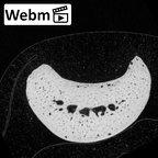 NH MER34 856 Gorilla gorilla gorilla hand phalanx fourth proximal left ct stack movie