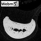 NH MER34 856 Gorilla gorilla gorilla hand phalanx second proximal left ct stack movie