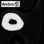 NH MER34 856 Gorilla gorilla gorilla metacarpal third left ct stack movie
