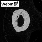 NH MER34 879 Gorilla gorilla gorilla hand phalanx first proximal left ct stack movie