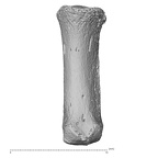 metacarpal first right