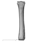 metacarpal third right