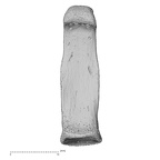 hand phalanx fourth proximal left