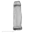 hand phalanx second proximal left