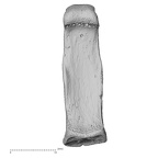 hand phalanx third proximal left