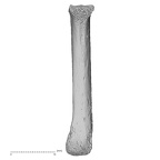metacarpal fifth left