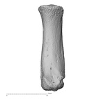 metacarpal first left