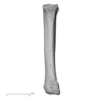 metacarpal second left