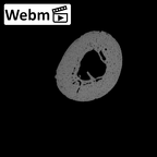 NH MER35 135 Gorilla gorilla gorilla hand phalanx first proximal left ct stack movie
