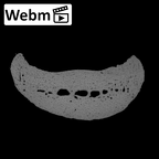 NH MER35 135 Gorilla gorilla gorilla hand phalanx third middle left ct stack movie