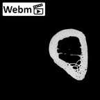 NH MER35 135 Gorilla gorilla gorilla metacarpal fifth left ct stack movie
