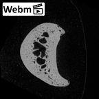 NH MER35 138 Gorilla gorilla gorilla hand phalanx fifth proximal left ct stack movie