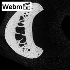 NH MER35 174 Gorilla gorilla gorilla hand phalanx fourth proximal right ct stack movie