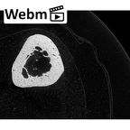 NH MER35 174 Gorilla gorilla gorilla metacarpal fourth right ct stack movie