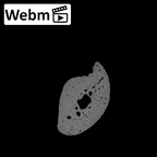 NH MER35 95 Gorilla gorilla gorilla hand phalanx fifth middle right ct stack movie