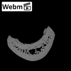 NH MER36 264 Gorilla gorilla gorilla hand phalanx third proximal left ct stack movie