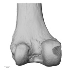 NH CAM1 106 Gorilla gorilla gorilla femur left distal posterior