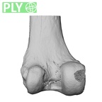 NH CAM1 106 Gorilla gorilla gorilla femur left distal ply