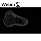 NH CAM1 106 Gorilla gorilla gorilla femur left proximal ct stack movie