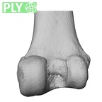 NH MER32 300 Gorilla gorilla gorilla femur right distal ply