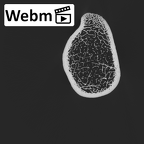 NH MER32 300 Gorilla gorilla ssp. tibia right proximal ct stack movie