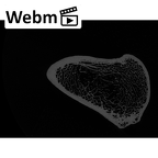 NH MER32 329 Gorilla gorilla gorilla femur left proximal ct stack movie
