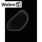 NH MER32 329 Gorilla gorilla gorilla tibia left proximal ct stack movie