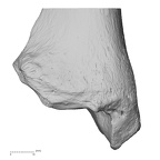 Lower limb