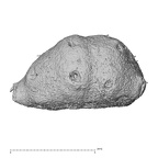 sesamoid foot