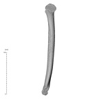 humerus right