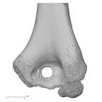 humerus right distal