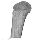 humerus right proximal