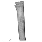 radius right proximal